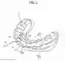 Fig. 03 - ORTHODONTIC APPLIANCE