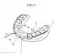 Fig. 07 - ORTHODONTIC APPLIANCE