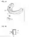 Fig. 08 - ORTHODONTIC APPLIANCE