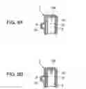 Fig. 09 - ORTHODONTIC APPLIANCE