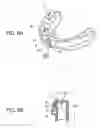 Fig. 10 - ORTHODONTIC APPLIANCE