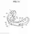 Fig. 11 - ORTHODONTIC APPLIANCE
