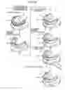 Fig. 20 - ORTHODONTIC APPLIANCE