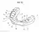 Fig. 23 - ORTHODONTIC APPLIANCE