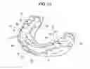 Fig. 24 - ORTHODONTIC APPLIANCE