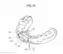 Fig. 25 - ORTHODONTIC APPLIANCE