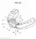 Fig. 26 - ORTHODONTIC APPLIANCE