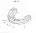Fig. 27 - ORTHODONTIC APPLIANCE