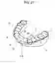 Fig. 28 - ORTHODONTIC APPLIANCE