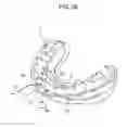 Fig. 30 - ORTHODONTIC APPLIANCE
