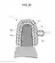 Fig. 31 - ORTHODONTIC APPLIANCE