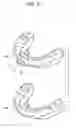 Fig. 32 - ORTHODONTIC APPLIANCE