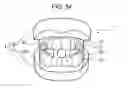 Fig. 35 - ORTHODONTIC APPLIANCE