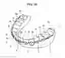 Fig. 40 - ORTHODONTIC APPLIANCE