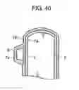 Fig. 41 - ORTHODONTIC APPLIANCE