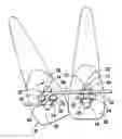 Fig. 01 - Orthodontic brace system and method