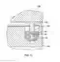 Fig. 15 - Orthodontic gripping device