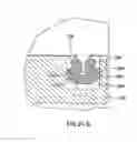 Fig. 30 - Orthodontic gripping device