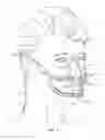 Fig. 02 - METHOD AND APPARATUS FOR REGULATING TOOTH MOVEMENT