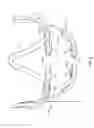 Fig. 03 - METHOD AND APPARATUS FOR REGULATING TOOTH MOVEMENT