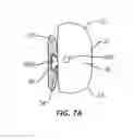 Fig. 08 - METHOD AND APPARATUS FOR REGULATING TOOTH MOVEMENT