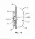 Fig. 09 - METHOD AND APPARATUS FOR REGULATING TOOTH MOVEMENT
