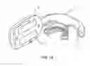 Fig. 19 - METHOD AND APPARATUS FOR REGULATING TOOTH MOVEMENT