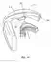 Fig. 20 - METHOD AND APPARATUS FOR REGULATING TOOTH MOVEMENT