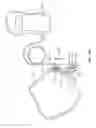 Fig. 23 - METHOD AND APPARATUS FOR REGULATING TOOTH MOVEMENT