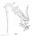 Fig. 05 - Methods useful for remodeling maxillofacial bone using light therapy and a functional appliance