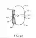 Fig. 08 - Methods useful for remodeling maxillofacial bone using light therapy and a functional appliance
