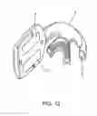Fig. 19 - Methods useful for remodeling maxillofacial bone using light therapy and a functional appliance