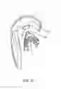 Fig. 20 - Methods useful for remodeling maxillofacial bone using light therapy and a functional appliance