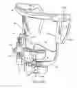 Fig. 27 - Methods useful for remodeling maxillofacial bone using light therapy and a functional appliance