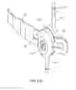 Fig. 28 - Methods useful for remodeling maxillofacial bone using light therapy and a functional appliance