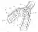 Fig. 01 - Impression Tray