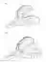 Fig. 04 - Impression Tray