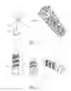 Fig. 03 - Dental implant
