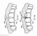Fig. 04 - Implants and methods for performing gingiva and bone augmentation and preservation