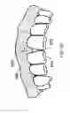 Fig. 05 - Implants and methods for performing gingiva and bone augmentation and preservation