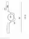 Fig. 09 - Implants and methods for performing gingiva and bone augmentation and preservation