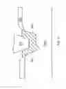 Fig. 10 - Implants and methods for performing gingiva and bone augmentation and preservation