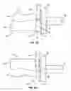 Fig. 06 - Method for Machining a Dental Prosthesis