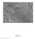 Fig. 03 - Nerve graft