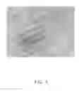 Fig. 08 - Nerve graft