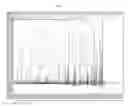 Fig. 04 - Biomarker for psychiatric diseases including cognitive impairment and methods for detecting psychiatric diseases including cognitive impairment using the biomarkers