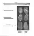 Fig. 17 - PEG-Urate Oxidase Conjugates and Use Thereof