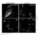Fig. 05 - METHODS AND KITS FOR REGULATING INTRACELLULAR TRAFFICKING OF A TARGET PROTEIN