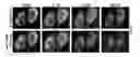 Fig. 08 - METHODS AND KITS FOR REGULATING INTRACELLULAR TRAFFICKING OF A TARGET PROTEIN