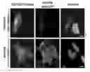 Fig. 10 - METHODS AND KITS FOR REGULATING INTRACELLULAR TRAFFICKING OF A TARGET PROTEIN